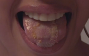 Das Netz auf der Zunge der Miss Wahl Teilnehmerin. Foto: BBC